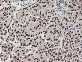 Monoclonal Mouse anti-Human TPRKB Antibody (clone OTI1E9, IHC, WB)