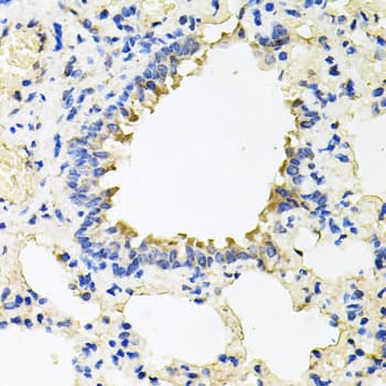 CALU / Calumenin Antibody
