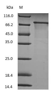 TF / Transferrin Protein (Native)