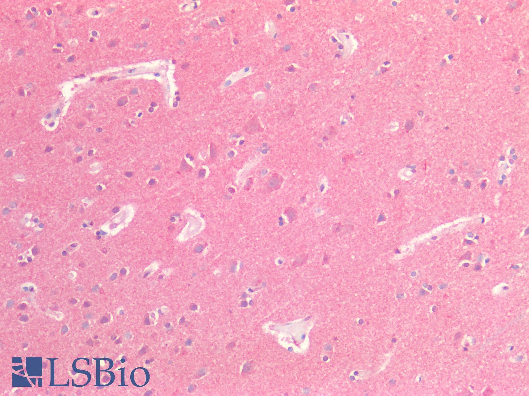 IHC-plus™ Polyclonal Rabbit anti-Human SIRPA / CD172a Antibody (IHC)