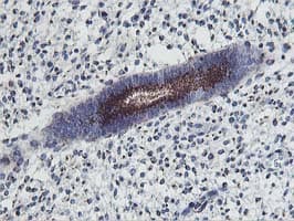 FXN / Frataxin Antibody (clone OTI1C12)