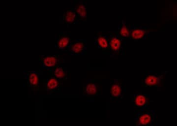 SPT3 / SUPT3H Antibody