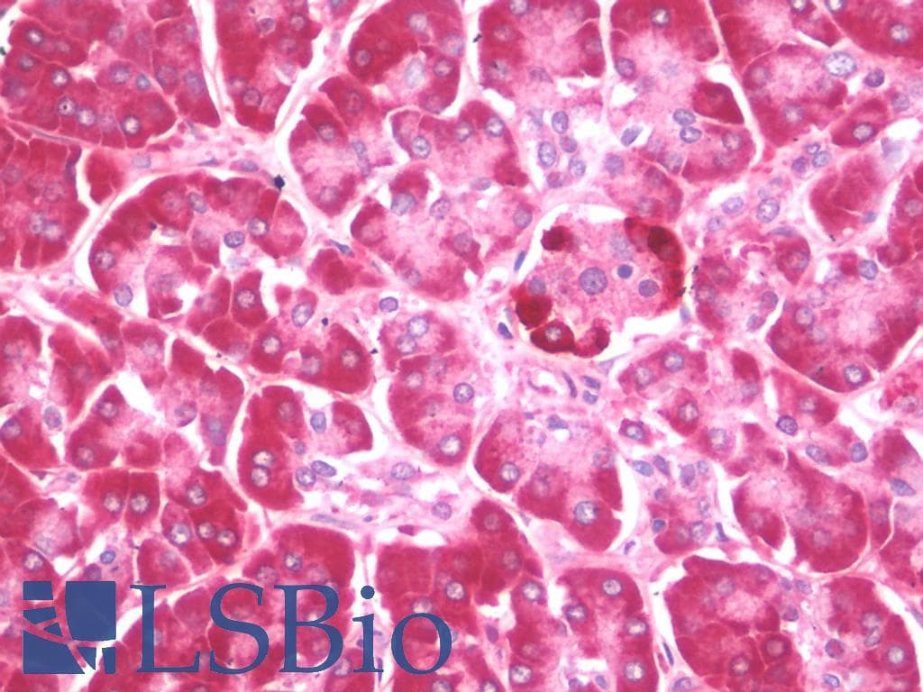 IHC-plus™ MAP1LC3B / LC3B Antibody