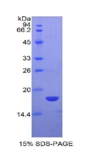 Rabbit IL15 Protein (Recombinant His)