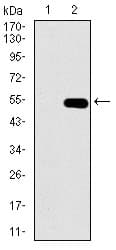 GUCY1A1 / GUCY1A3 Antibody (aa22-214, clone 3G6B2)