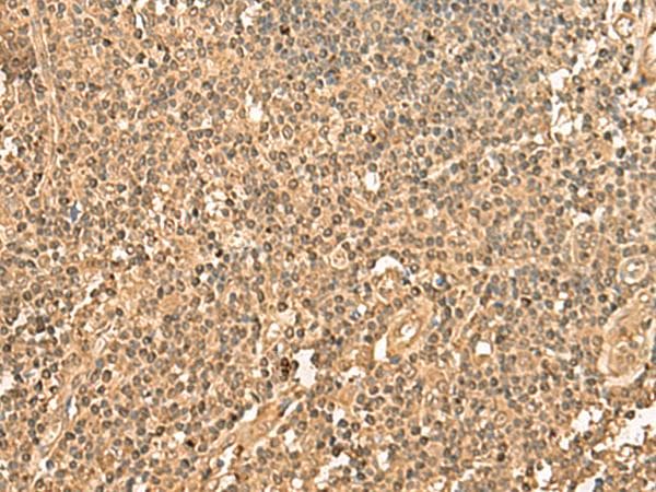Polyclonal Rabbit anti-Human PPM1G Antibody (IHC)