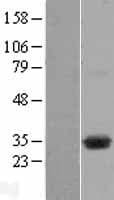 DHRSX Protein (Over-Expression Lysate Myc-DDK (Flag))