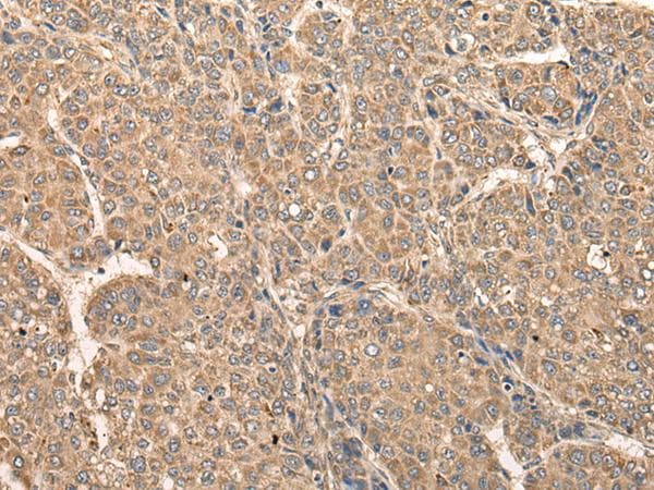 Polyclonal Rabbit anti-Human RCAN3 / Calcipressin 3 Antibody (IHC)
