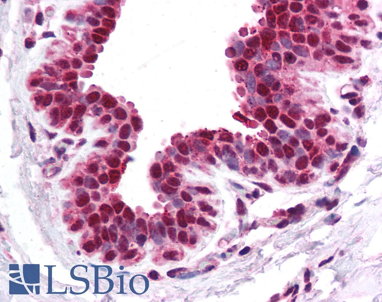 CACNB1 Antibody (aa21-70)
