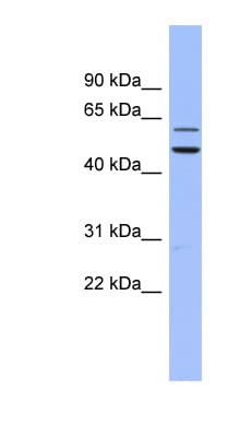Polyclonal Rabbit anti-Human DKC1 / Dyskerin Antibody (aa35-84, WB)
