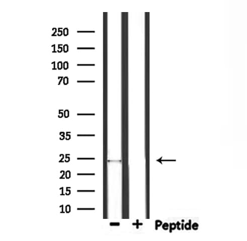 Polyclonal Rabbit anti-Human ZNRF1 Antibody (IHC, IF, WB)