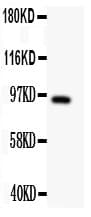 Polyclonal Rabbit anti-Human DISC1 Antibody (aa461-477, IHC, WB)