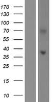 LPPR5 Protein (Over-Expression Lysate Myc-DDK (Flag))