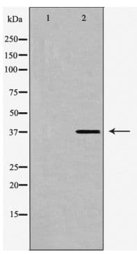 SUCNR1 / GPR91 Antibody
