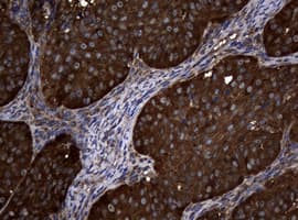 NME1 / NM23 Antibody (clone OTI1H4)