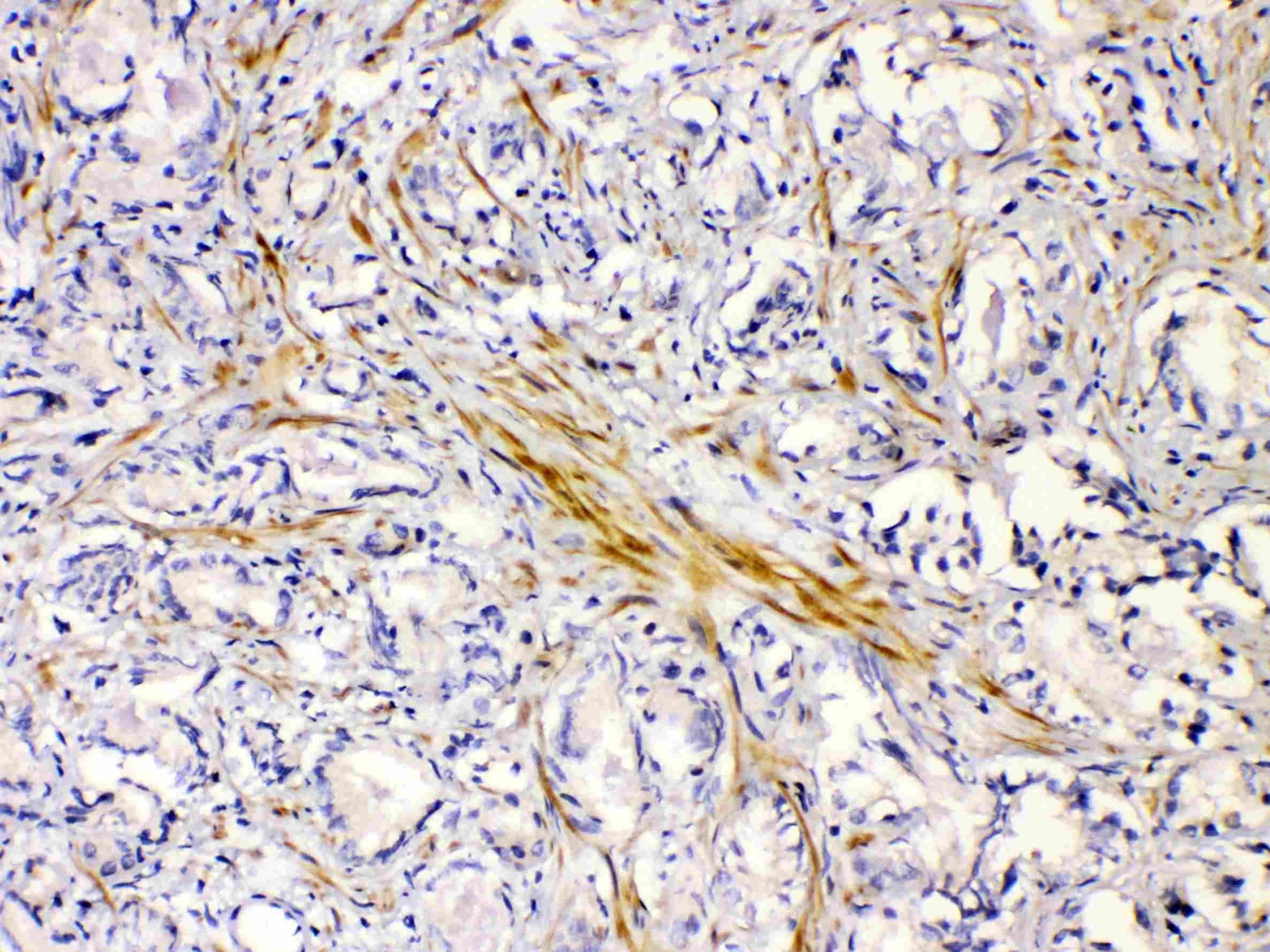 Polyclonal Rabbit anti-Human CHRNA5 Antibody (IHC, WB)