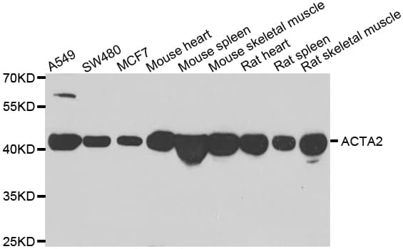 IHC-plus™ Polyclonal Rabbit anti-Human ACTA2 / Smooth Muscle Actin Antibody (IHC, WB)