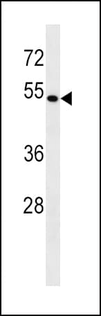 BAG4 / SODD Antibody (aa381-409)