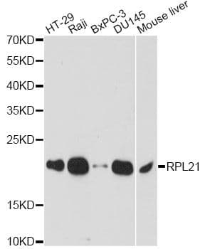 RPL21 / Ribosomal Protein L21 Antibody