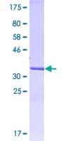 Human CCR1 Protein (Recombinant GST, N-terminus)