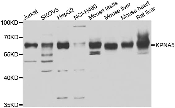 Polyclonal Rabbit anti-Human KPNA5 Antibody (IHC, WB)