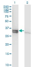 CASP1 / Caspase 1 Antibody (clone 3D2)