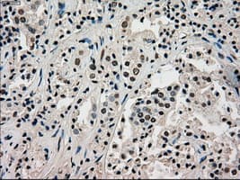Monoclonal Mouse anti-Human PMEL / SILV / gp100 Antibody (clone OTI10E5, IHC, IF, WB)