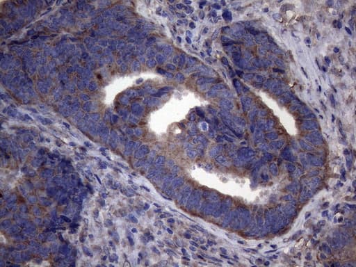 NARS2 Antibody (clone OTI8D10)