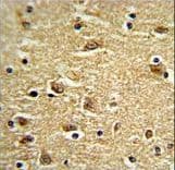 Polyclonal Rabbit anti-Human FAK / Focal Adhesion Kinase Antibody (aa821-848, IHC, IF, WB)