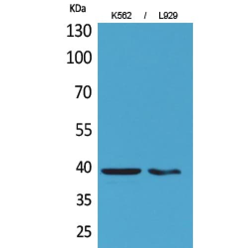 Polyclonal Rabbit anti-Human CD84 / SLAMF5 Antibody (121-170 aa, Internal, WB)