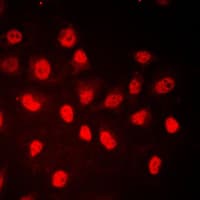 Polyclonal Rabbit anti-Human RB1 / Retinoblastoma / RB Antibody (phospho-Ser780, IHC, IF, WB)
