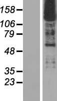 SMARCC2 Protein (Over-Expression Lysate Myc-DDK (Flag))