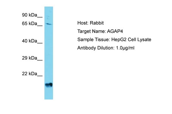 Polyclonal Rabbit anti-Human AGAP4 Antibody (aa501-550, WB)