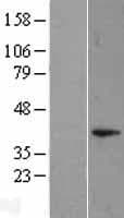 DUSP11 Protein (Over-Expression Lysate Myc-DDK (Flag))