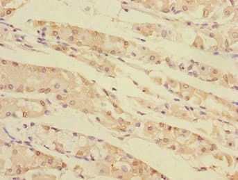 TXNDC5 / ERP46 Antibody