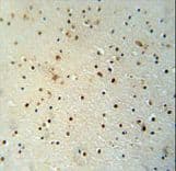 MED25 Antibody (aa112-140)