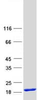 Human TRAPPC1 / MUM2 Protein (Recombinant Myc-DDK (Flag))