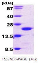 Human CFL1 / Cofilin Protein (Recombinant His)