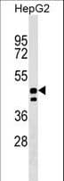 UNC93A Antibody (aa110-137)