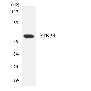 Polyclonal Rabbit anti-Human STK39 / SPAK Antibody (aa345-394, WB)