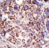 USP3 / UBP Antibody (aa489-519)