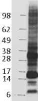 CD52 Protein (Over-Expression Lysate Myc-DDK (Flag))