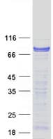 Human CSDE1 Protein (Recombinant Myc-DDK (Flag))