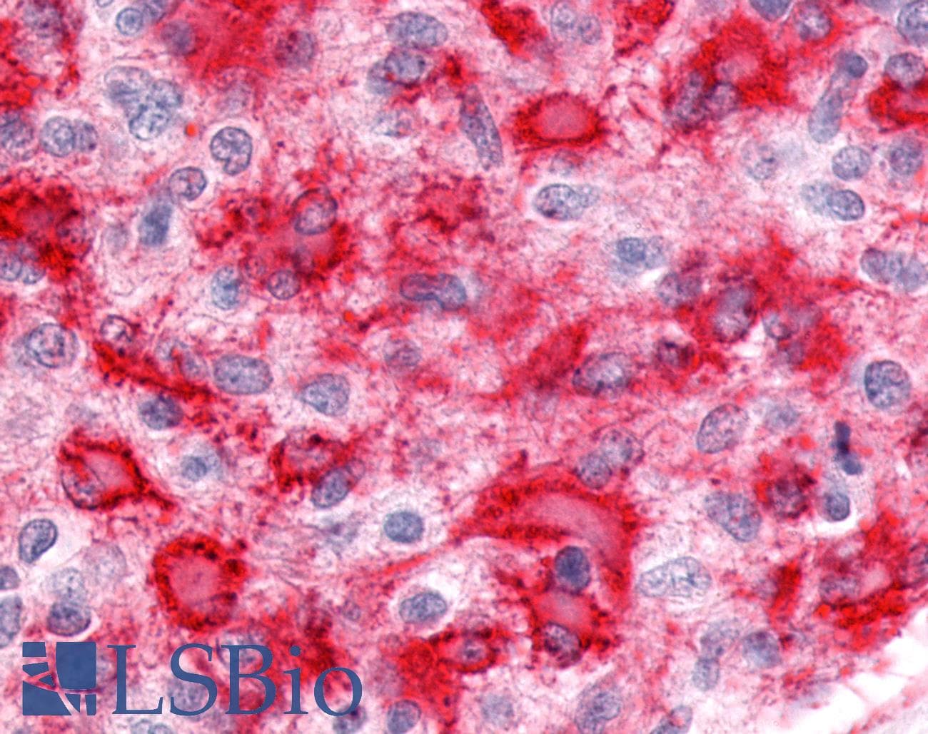 PathPlus™ Polyclonal Rabbit anti-Human ESRRG / ERR Gamma Antibody (C-Terminus, IHC, WB)