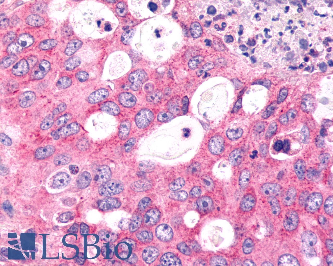 PathPlus™ Polyclonal Rabbit anti-Human FZD6 / Frizzled 6 Antibody (N-Terminus, IHC)