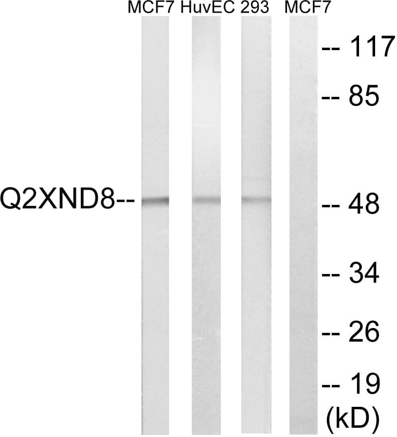 CYP2D6 Antibody (aa41-90)