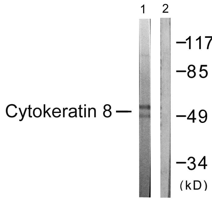 KRT8 / CK8 / Cytokeratin 8 Antibody (p431)