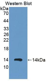 S100A12 Antibody (aa2-92)