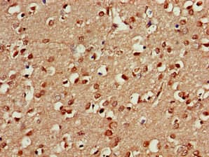 Polyclonal Rabbit anti-Human PSMA5 Antibody (IHC, WB)