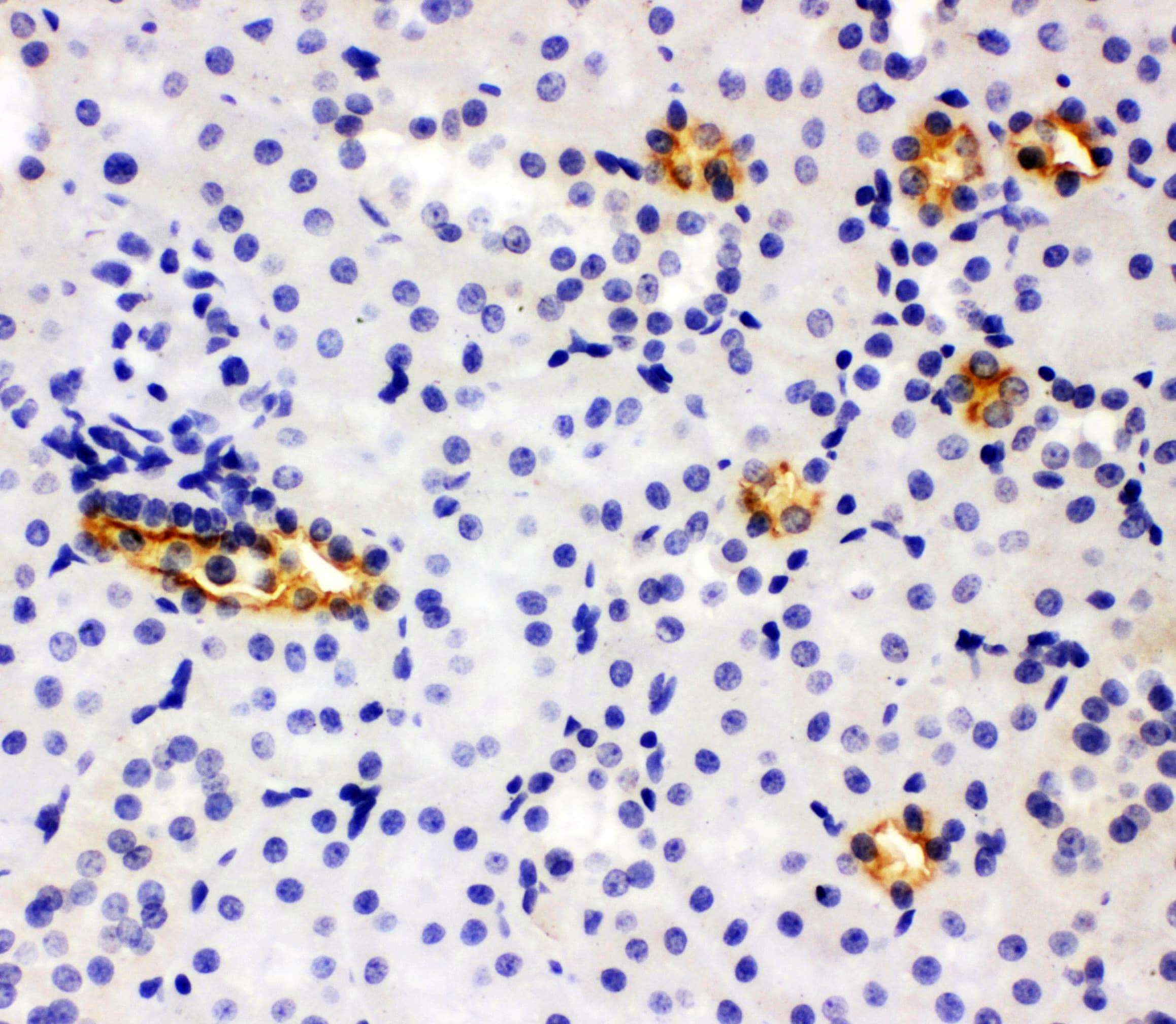 Polyclonal Rabbit anti-Human SLC12A1 / NKCC2 Antibody (aa125-139, IHC, WB)